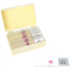Set 10 lamele cu preparate microscopice, Tesuturi umane afectate, 7, 6 x 2, 5 x 0, 1 cm, uz didactic imagine