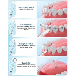 Set 4 duze interschimbabile pentru irigator bucal imagine